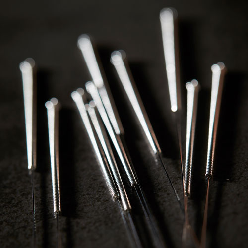 Badim-Acupuncture-needle-benifist1